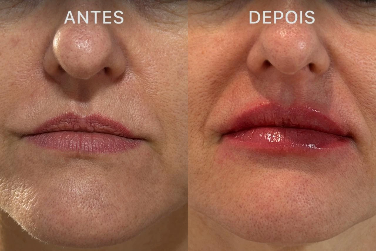 Antes e Depois Dra Lívia 9