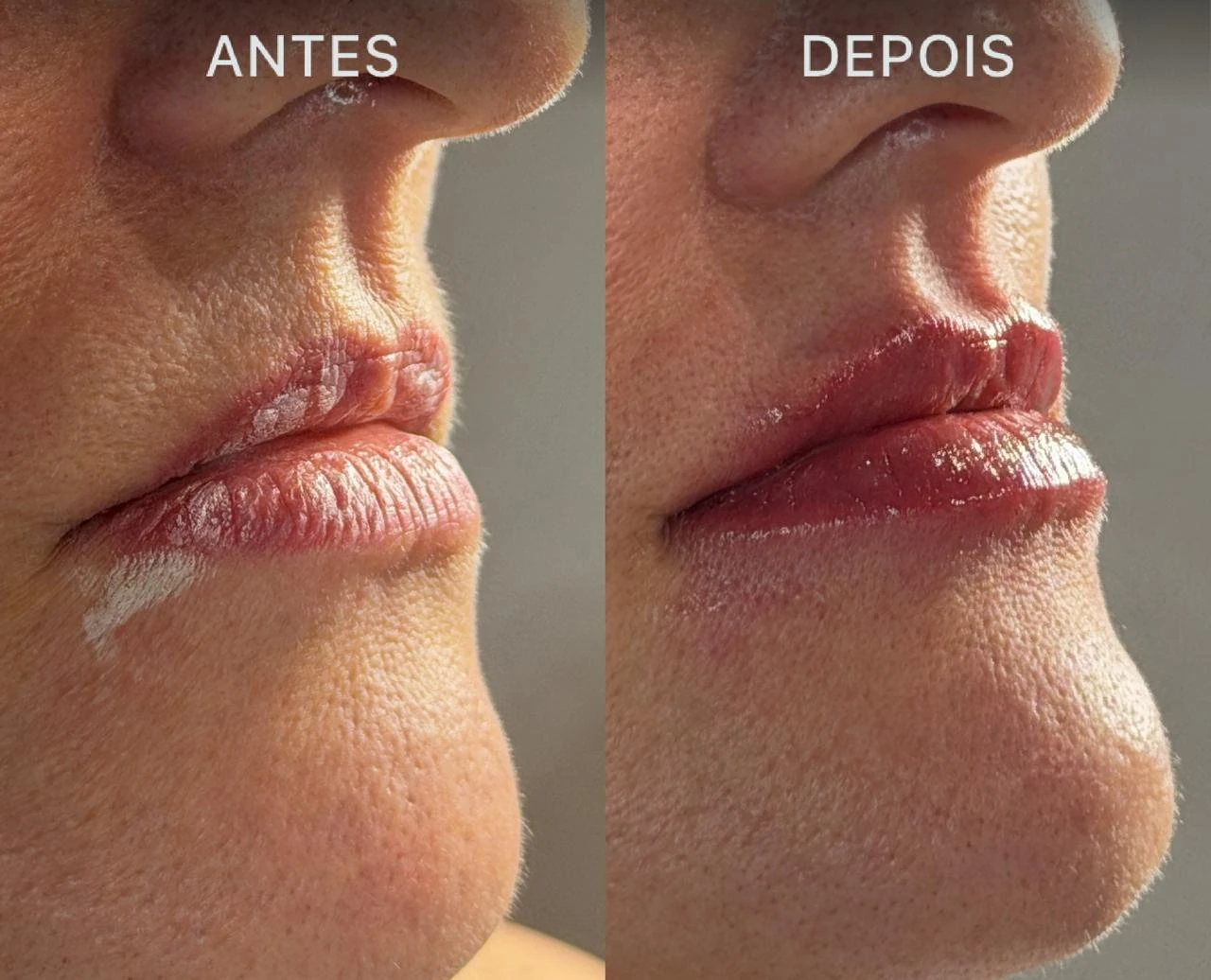 Antes e Depois Dra Lívia 11