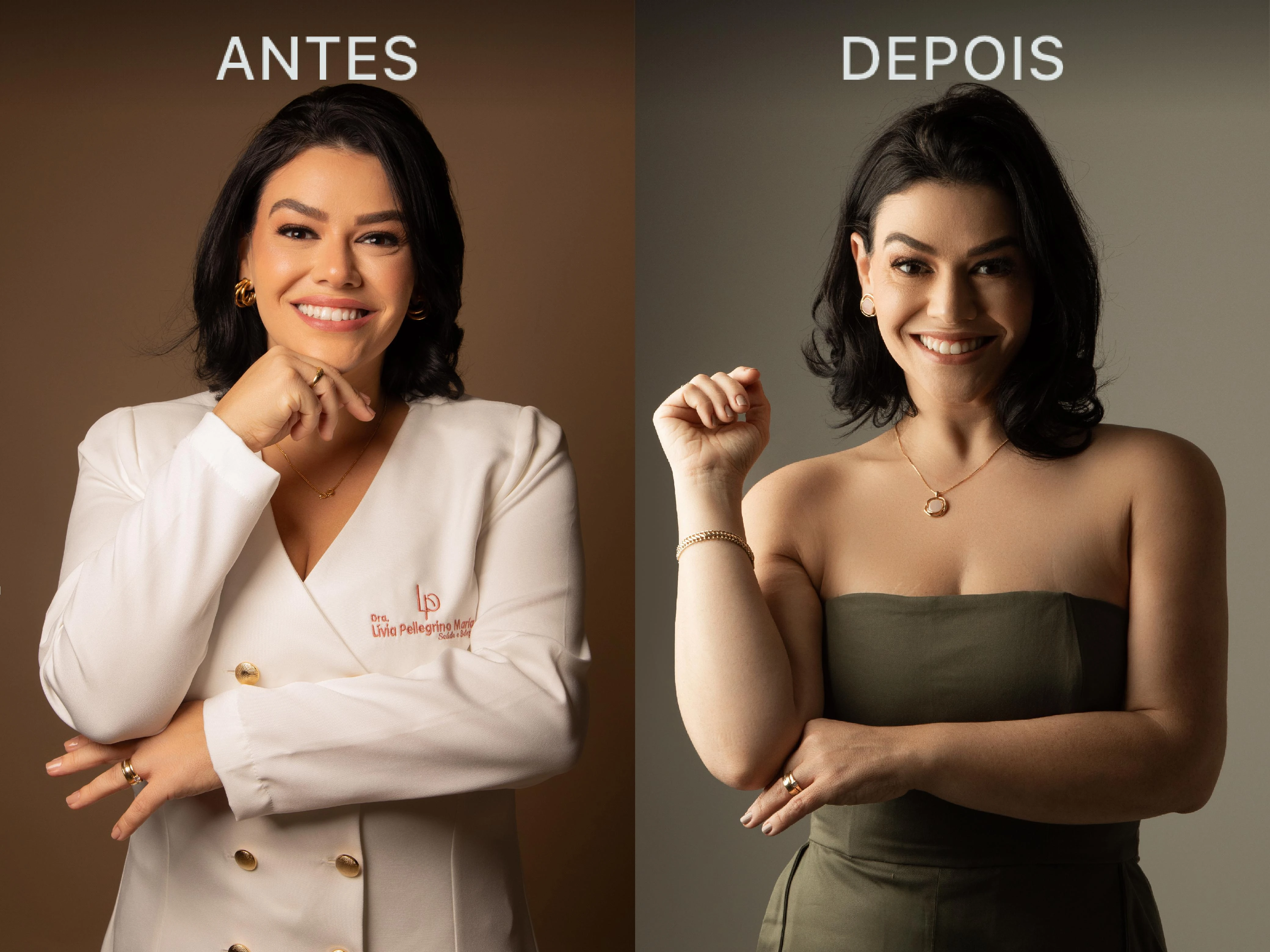 Antes e Depois Dra Lívia 18
