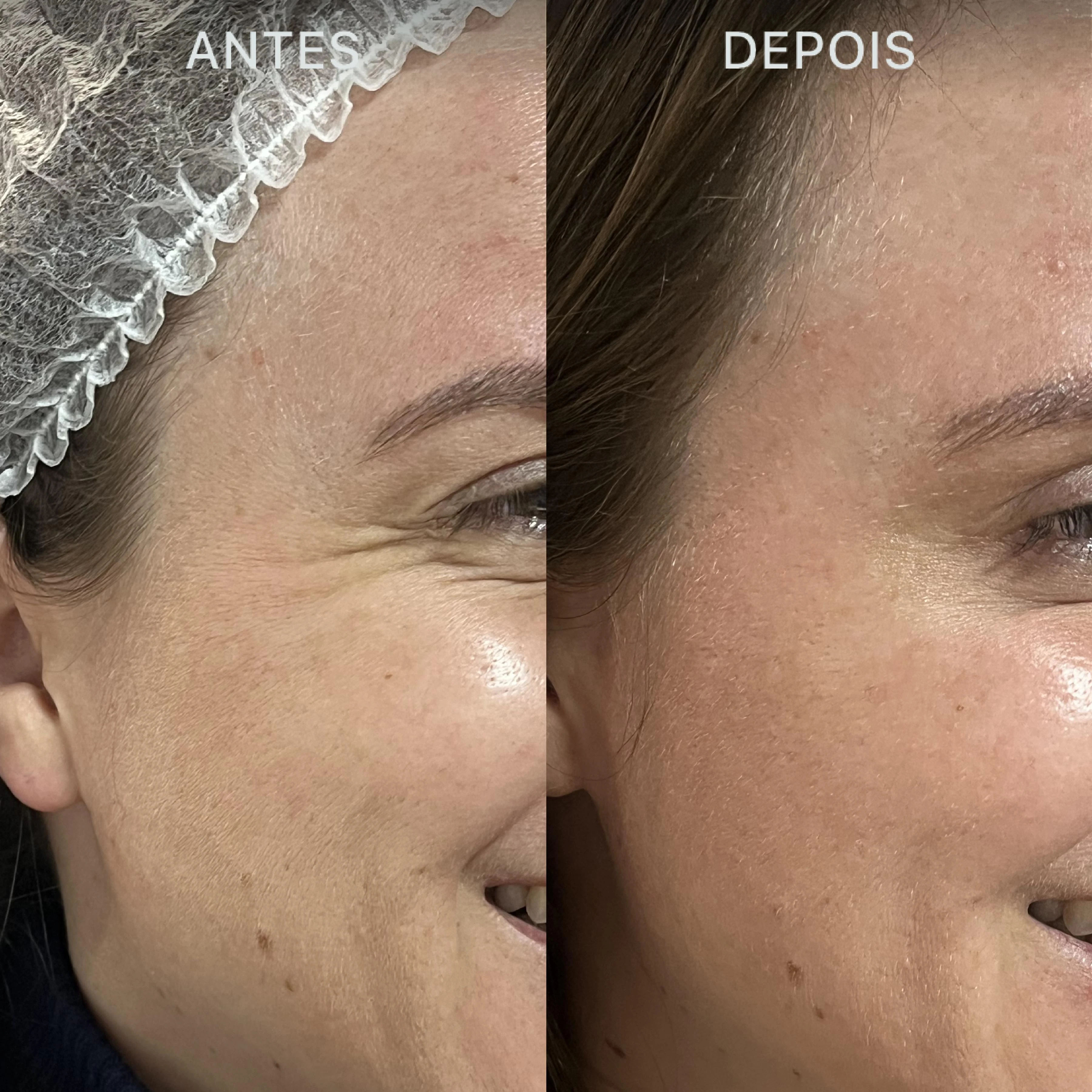 Antes e Depois Dra Lívia 25