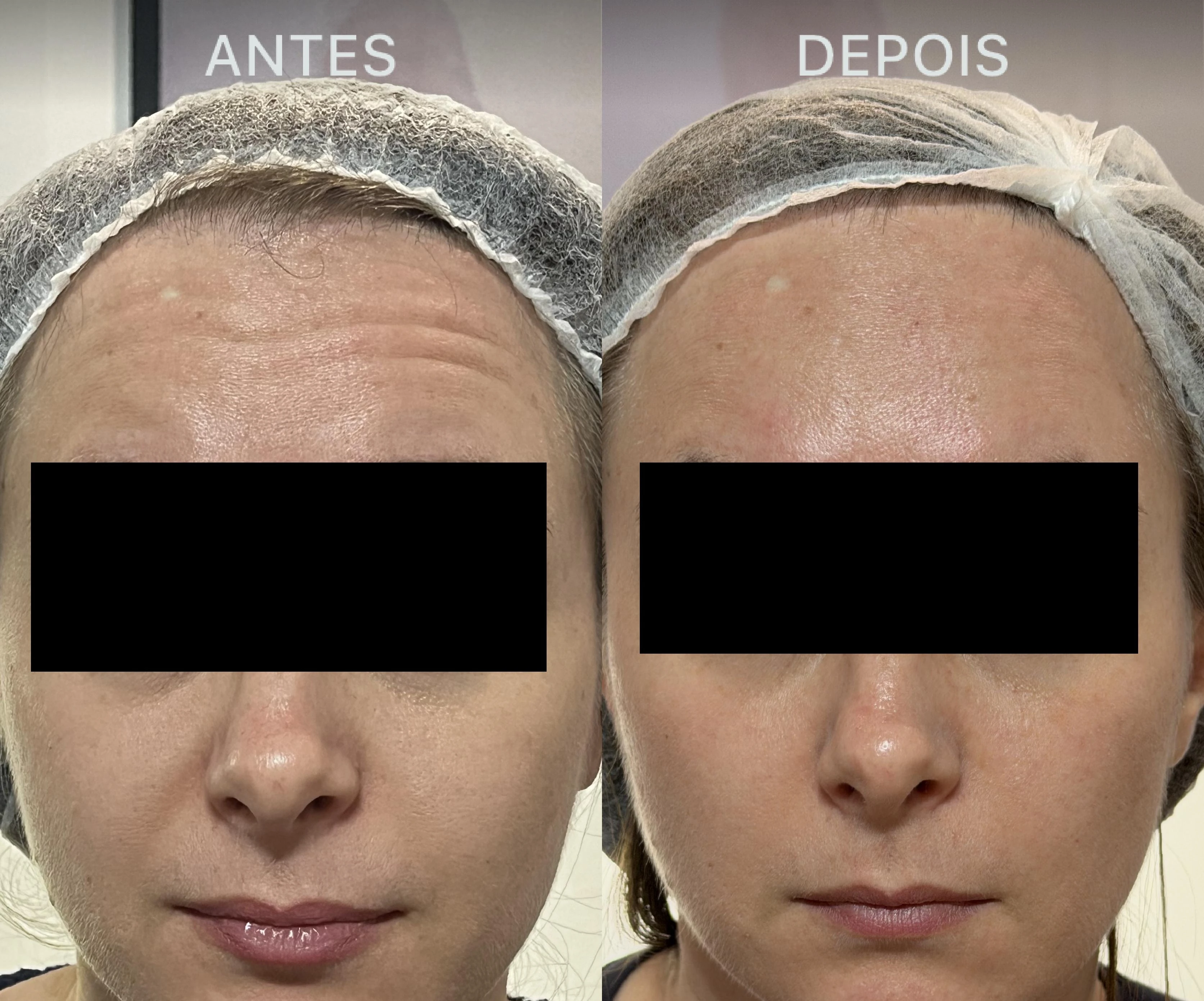 Antes e Depois Dra Lívia 26