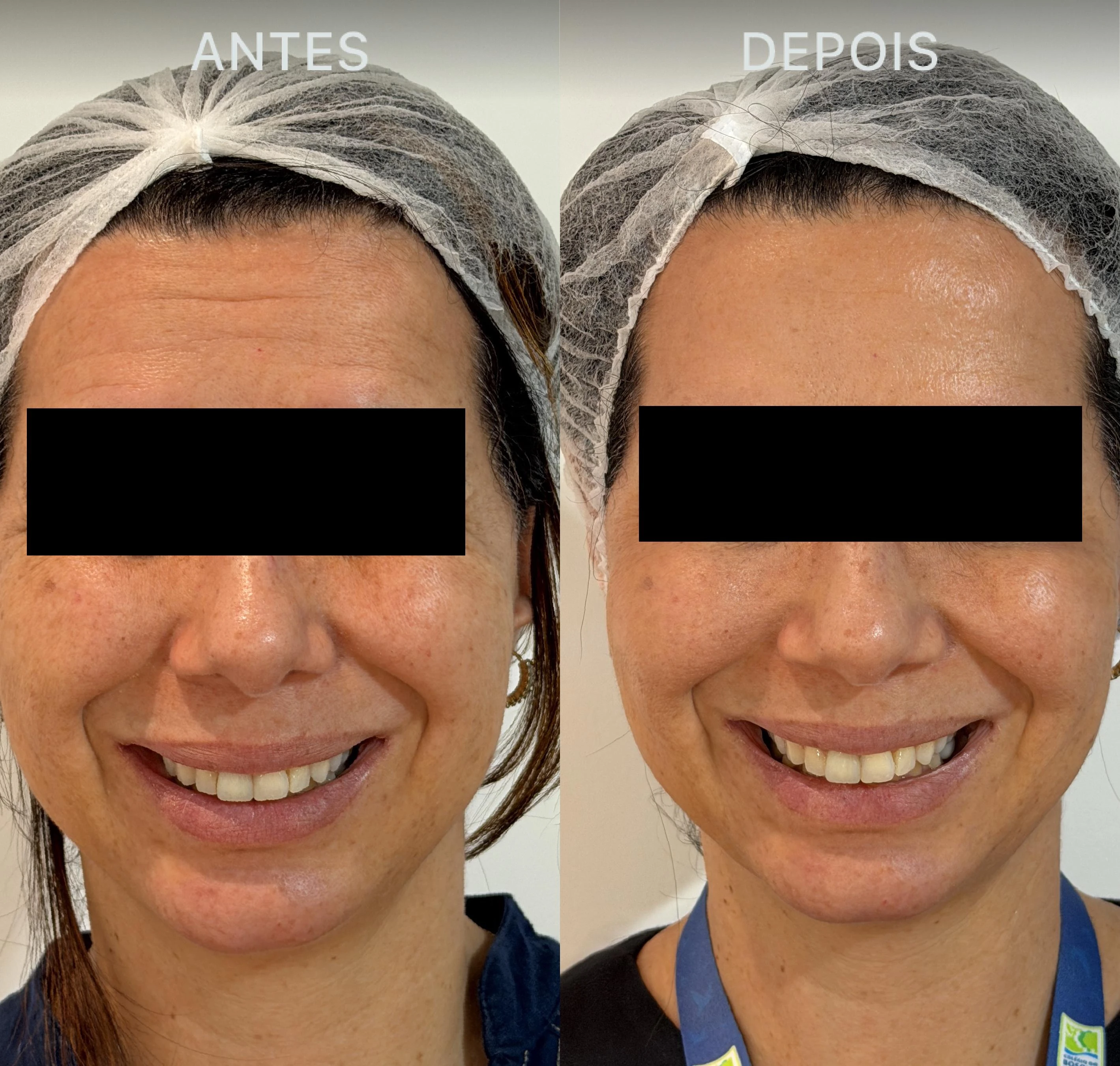 Antes e Depois Dra Lívia 27