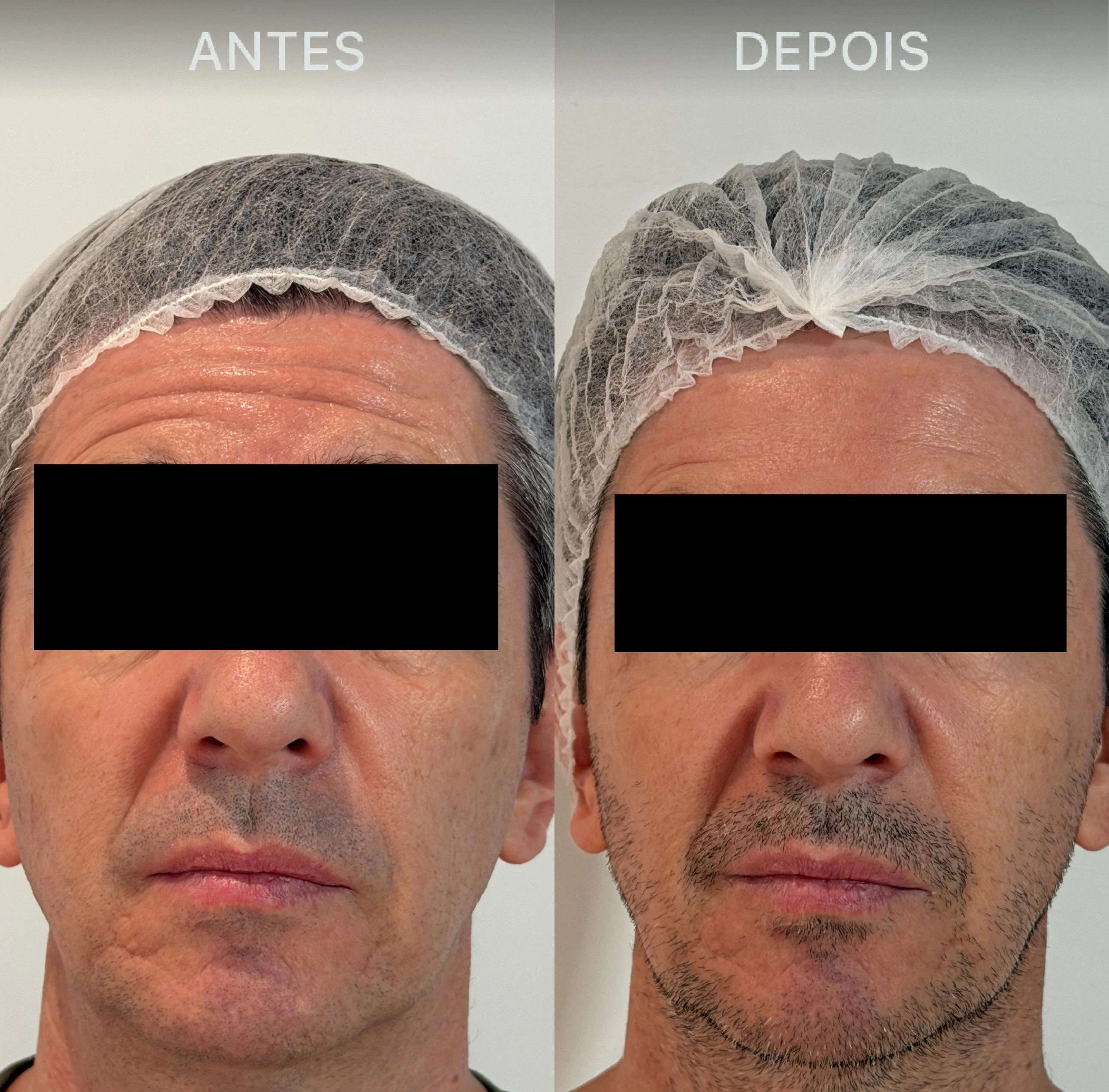 Antes e Depois Dra Lívia 29