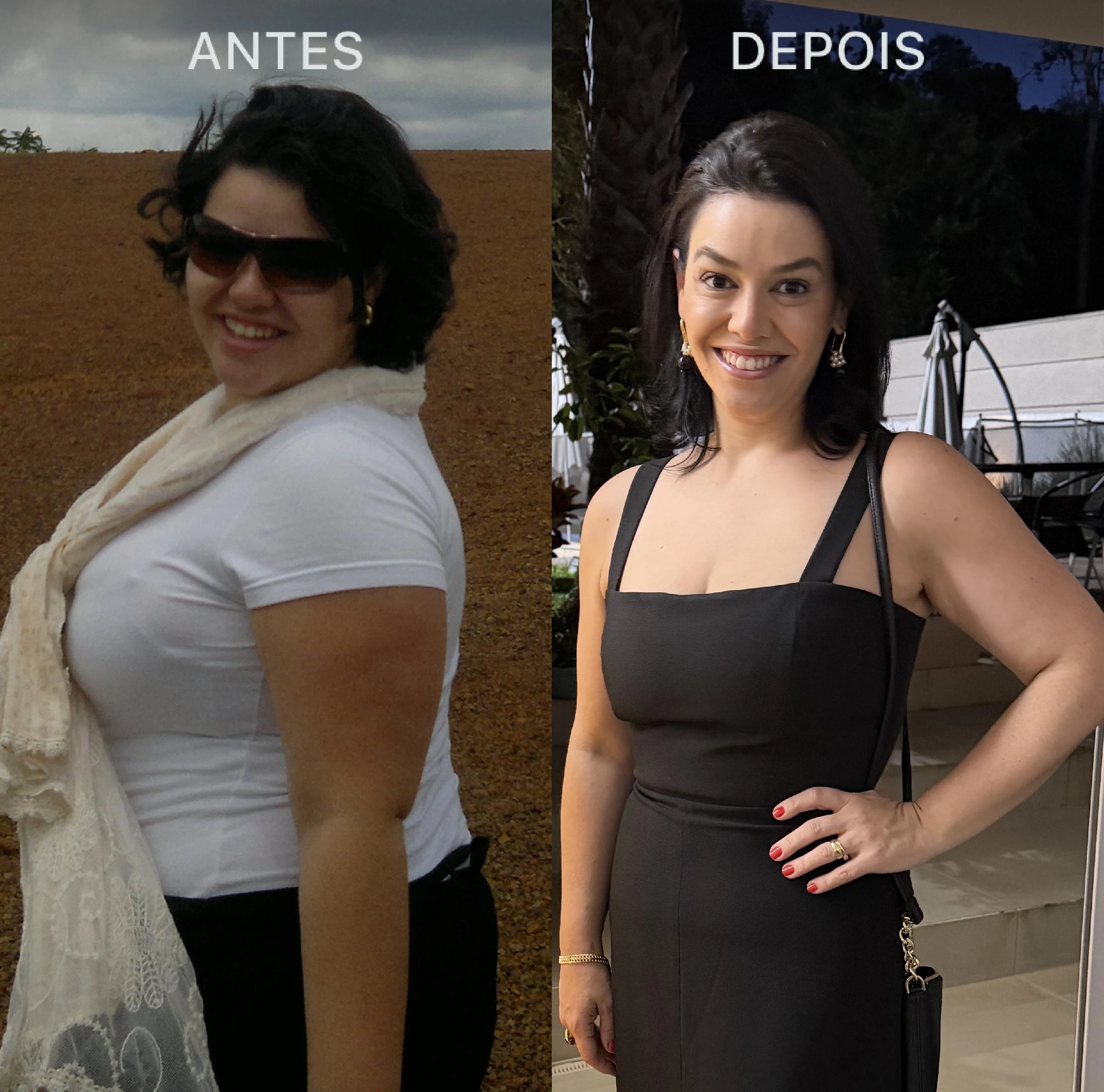 Antes e Depois Dra Lívia 1