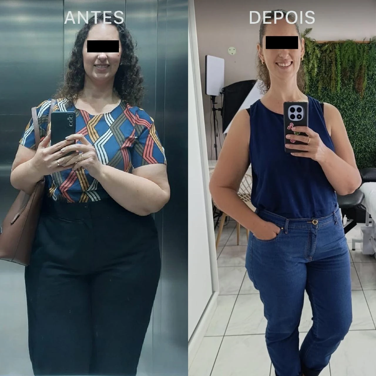 Antes e Depois Dra Lívia 2