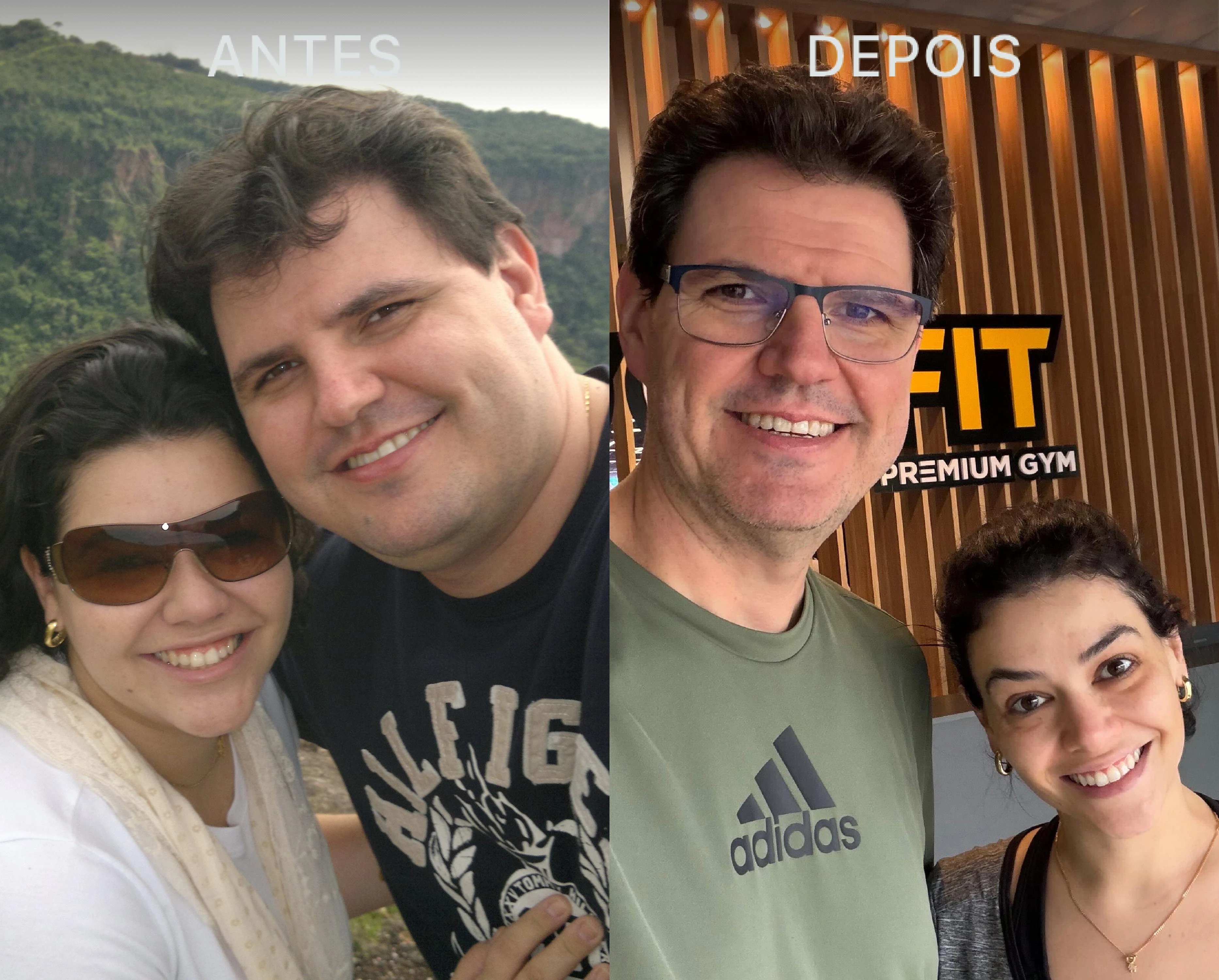 Antes e Depois Dra Lívia 3