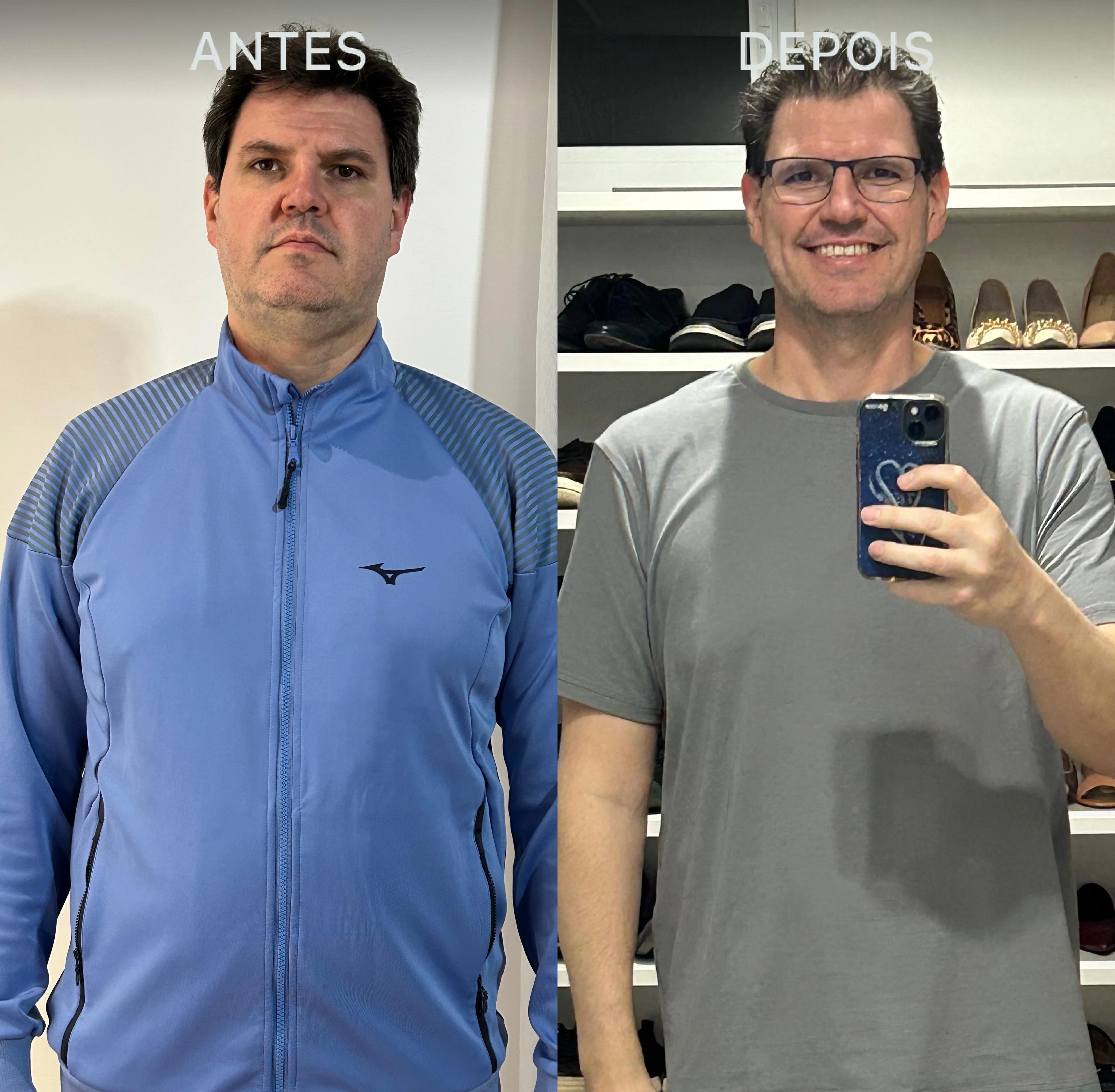 Antes e Depois Dra Lívia 4