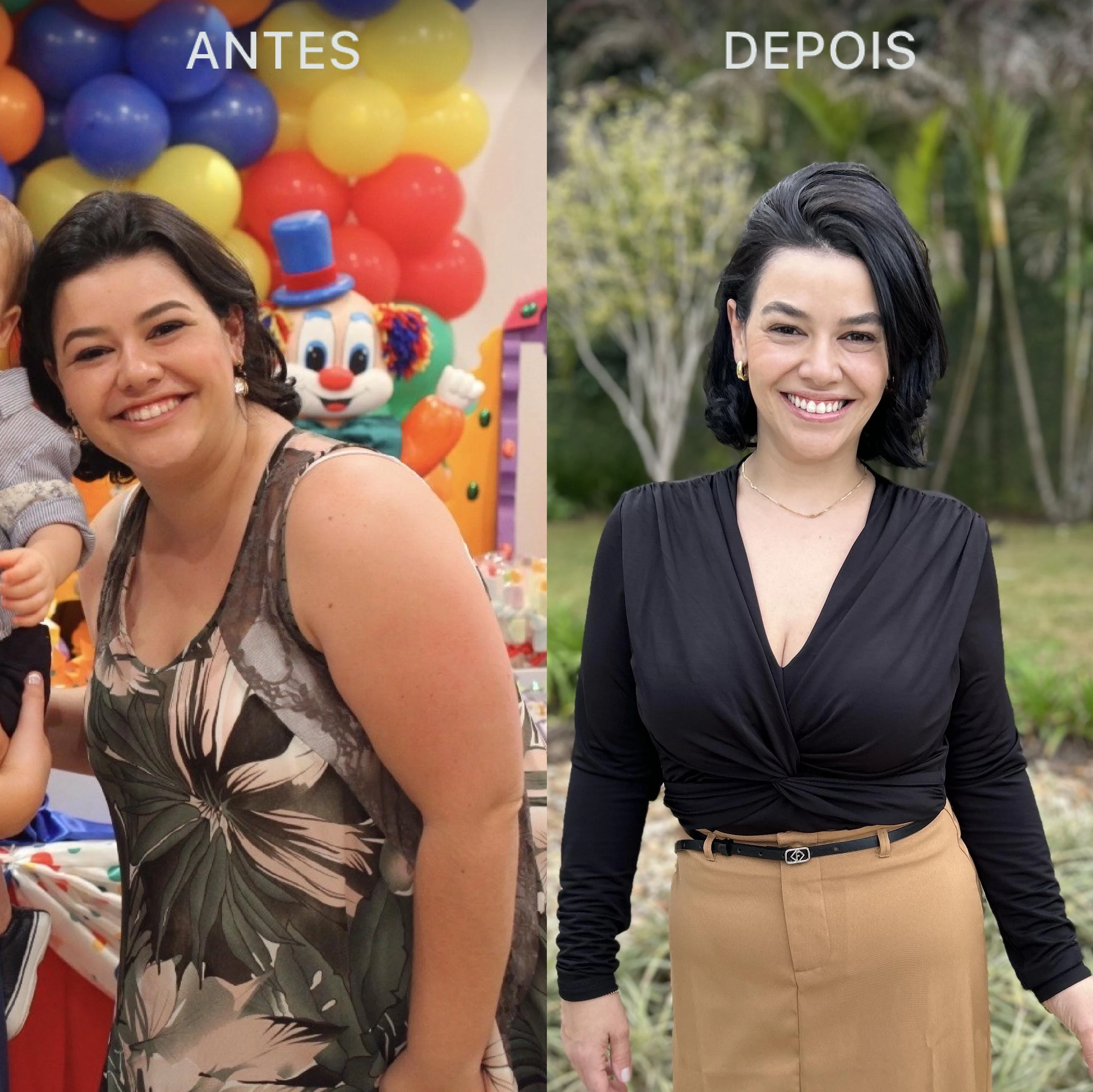 Antes e Depois Dra Lívia 5