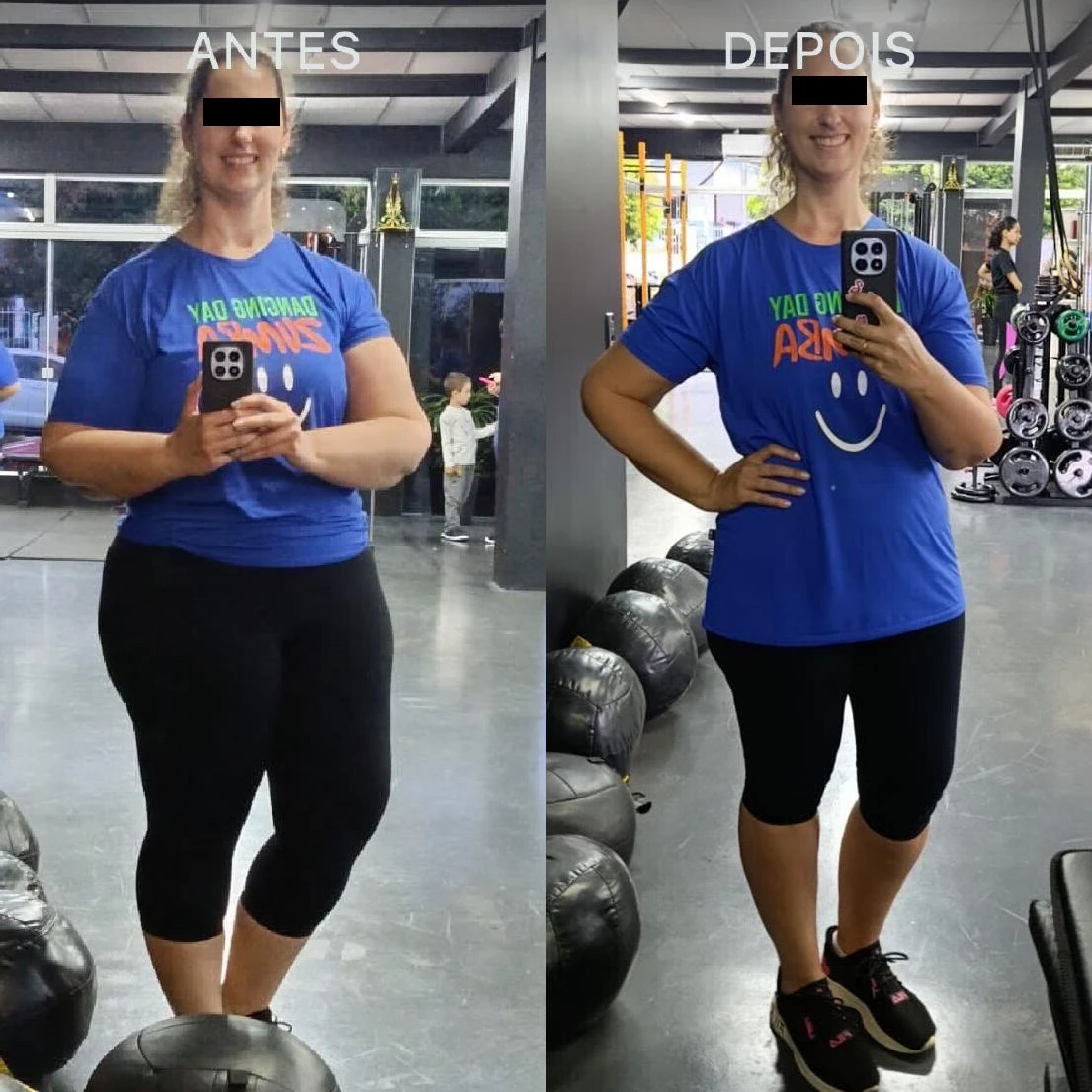 Antes e Depois Dra Lívia 7