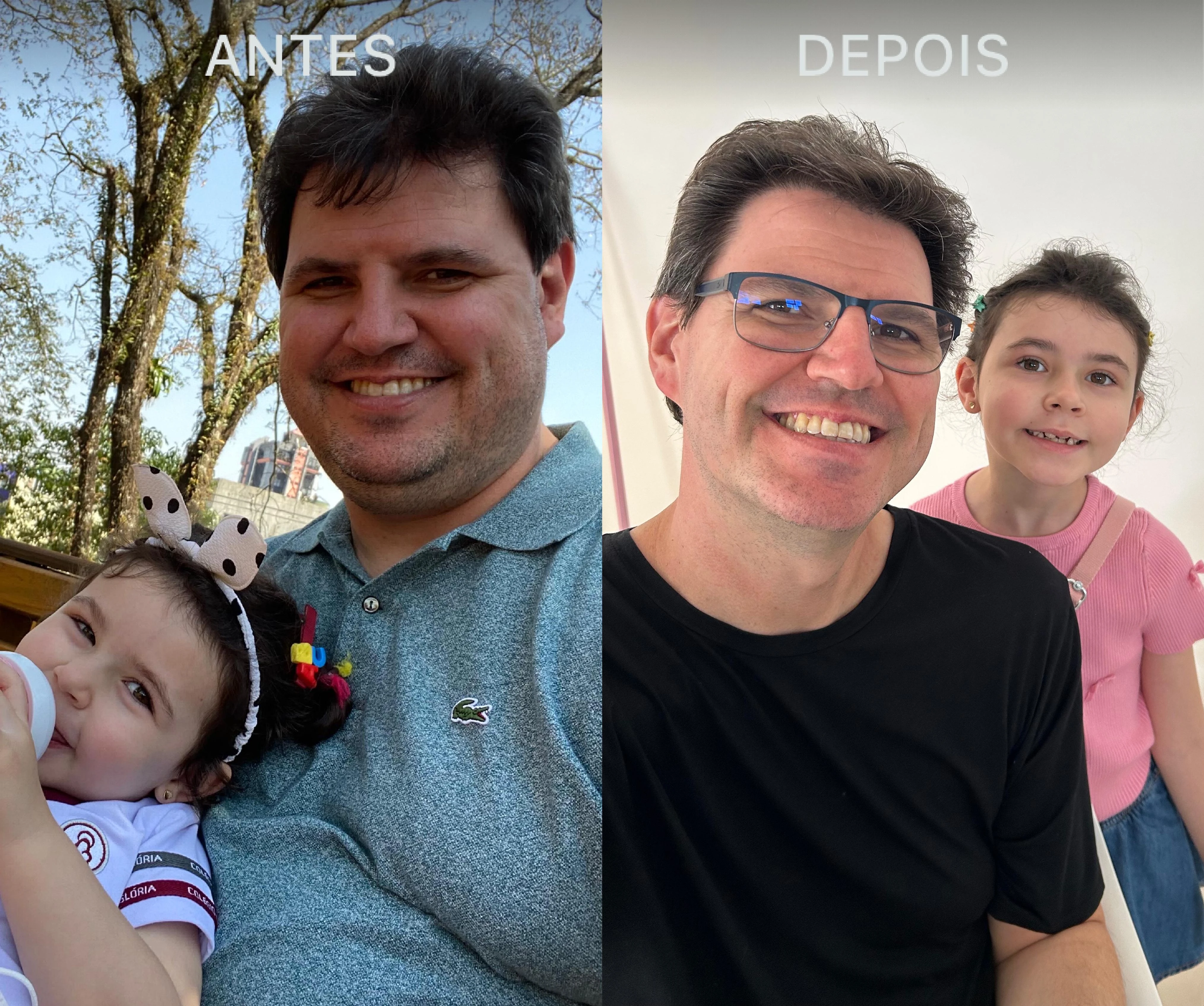 Antes e Depois Dra Lívia 8